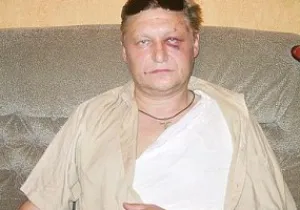 Блогери звинуватили побитого на стадіоні Динамо в українофобії
